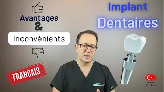 !!! Les Avantages et Les Inconvenients des Implants Dentaires !!! Turquie