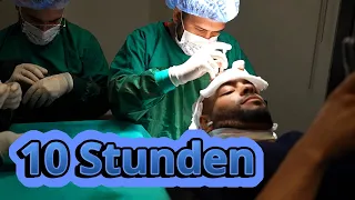 Haartransplantation mit Anthony Green – Der komplette Erfahrungsbericht!