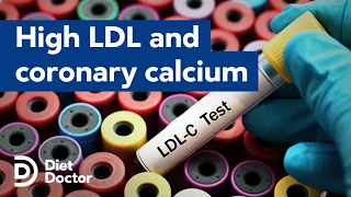 High LDL and coronary calcium