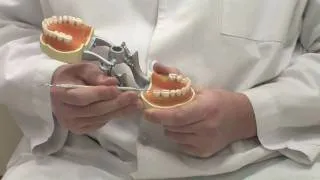 Dental Gold : Advantages of Gold Dental Fillings