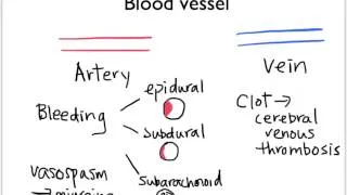 Approach to headache - Part 1