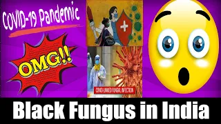 COVID-19 Pandemic – Mucormycosis The 'black fungus' maiming Covid patients in India