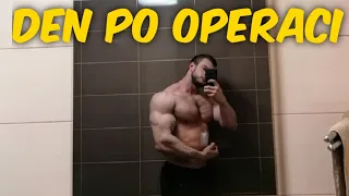 #1 Kýla | povídání den po operaci