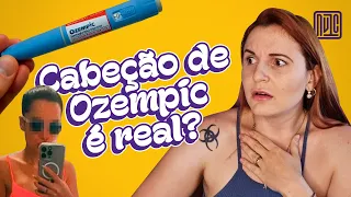 O que sabemos sobre o 'Cabeção de Ozempic'