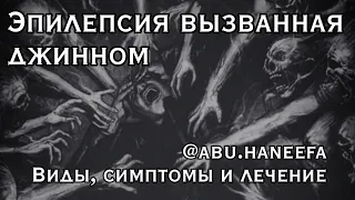 Эпилепсия вызванная джинном – различие, симптомы, лечение. | 🗣️@abu.haneefa