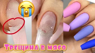 Трещина в мясо 😬 Ремонт нарощенных ногтей ватой без акригеля / Идеальный матовый топ