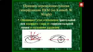 Метод дозированной передней транспозиции нижней...