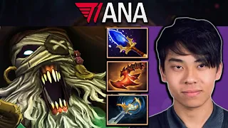 Undying Dota 2 7.32 Gameplay T1.Ana with 26 Kills and Carry Build #dota2 #dota2gameplay