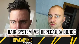 Какой метод лечения облысения выбрать? Hair system или пересадка волос? / Красавчик