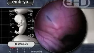 The Human Embryo Eight Weeks After Conception