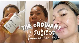 รีวิว โทนเนอร์ ที่เปลี่ยนผิวได้ใน 7 วัน แบบไม่มโน The Ordinary Glycolic Acid 7% Toning Solution