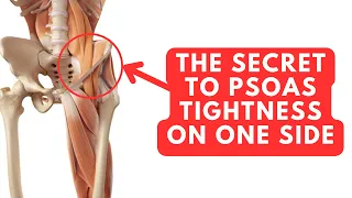 The Secret To Psoas Tightness On One Side (why is no one talking about this?)