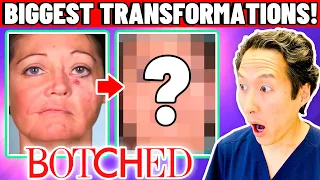 Plastic Surgeon Reacts to BOTCHED: The Most AMAZING Transformations!