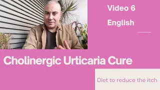 Cholinergic Urticaria Cure 2022 ||  Reducing The Itch || Video 6 English