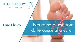 Neuroma di Morton: le cause, l'intervento e la riabilitazione | Dott. Andrea Scala