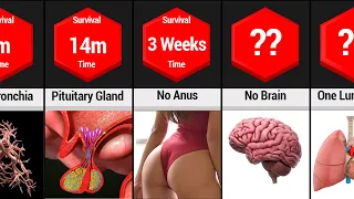 Comparison: Survival Without Organs | Survival Of Human Body Without Organs