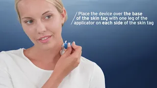 EXCILOR SKIN TAG iINSTRUCTION MOVIE