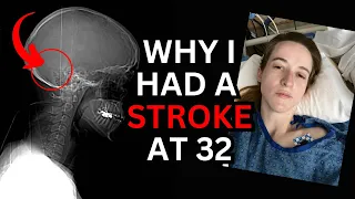 Why I Had a Stroke At Age 32?
