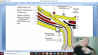 Hernia in Arabic 11 ( Indirect Inguinal hernia , part 2 ) , by Dr. Wahdan