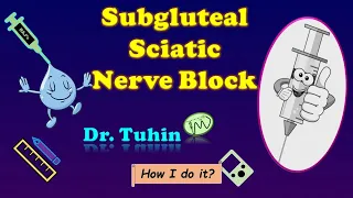 RAJ Approach | PNS guided Proximal Sciatic Nerve Block| Lithotomy Approach | @DrTuhinM