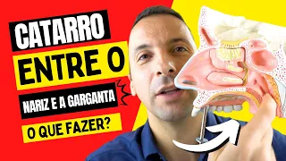 COMO ELIMINAR O CATARRO QUE FICA ENTRE O NARIZ E A GARGANTA