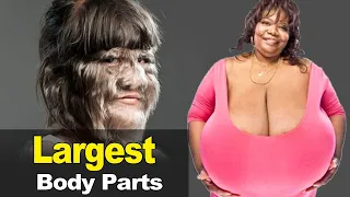 The 10 Largest Body Parts in World Sam Tv