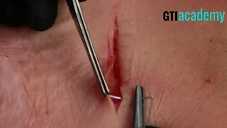 Suture Skills Skills | Simple Running Suture