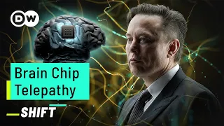 Brain Chip “Telepathy” – Musk’s breakthrough?