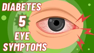 Diabetes: TOP 5 EYE Symptoms You Must Be Aware Of