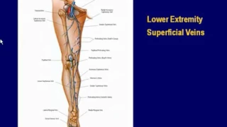 Lower Extremity Veins Techniques and Interpretation with How To Demonstration