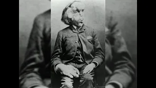 L'UOMO ELEFANTE – L'INCREDIBILE CASO DI JOSEPH MERRICK