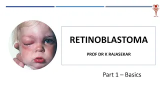 Prof Dr K Rajasekar  - Retinoblastoma 1- Ophthalmology MASTER CLASS  - POWER NOTES - MMC RIOGOH