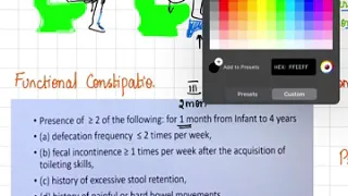 Childhood functional constipation-MD/DCH/DNB Pediatrics exam preparation