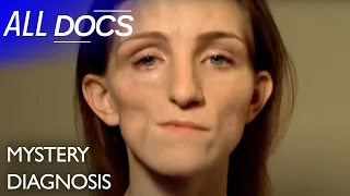 Nichole Beavers Loosing Half Of Her FACE 😲 | S08 E02 | Medical Documentary | All Documentary