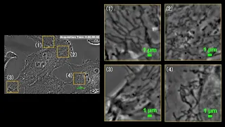 HeLa cell, Live cell imaging, mitochondria and actin dynamics, Label-free Phase contrast microscopy.