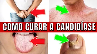 THE ONLY WAY TO END CANDIDIASIS FOREVER HOW TO ELIMINATE CANDIDA NATURALLY