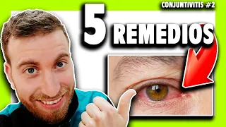 ▶️ ¿Cómo CURAR la CONJUNTIVITIS en el OJO? Todo lo que debes saber... [Capítulo #2]