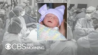 Woman gives birth after receiving uterus transplant from a dead donor