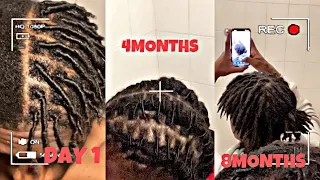 8 Months Starter Locs/ Dreadlocks Journey *Trust the Process*