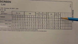 Blood Banking: Antibody Screen Set-up Part 2