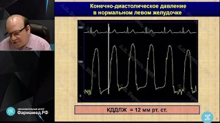 Острая сердечная недостаточность