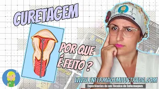 CURETAGEM: Por que é feito este procedimento ?