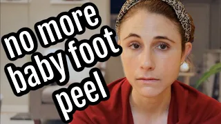 Forget the baby foot peel: MUST DOs for dry cracked heels| Dr Dray