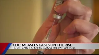 CDC releases measles numbers