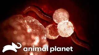 A Worm-like Parasite Attacks A Child's Eye | Monsters Inside Me | Animal Planet