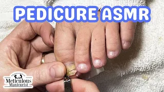 👣ASMR Pedicure Cleaning💆‍♀️Toenail Recovery Pedicure Tutorial👣