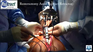 Rultract Resternotomy Assist REDO Medium Retractor Gen 4. Pediatric Heart Surgery