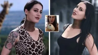 Woman wanting to Look Like a Giraffe Finally Removes her Neck Rings after 5 Years