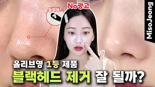 Will the No. 1 cleansing product in Korea remove blackheads well? (without Vaseline)