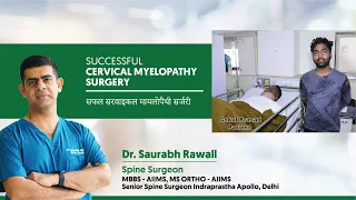 SUCCESSFUL CERVICAL MYELOPATHY SURGERY.  सफल सरवाइकल मायलोपैथी सर्जरी